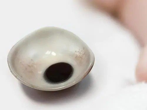 義眼